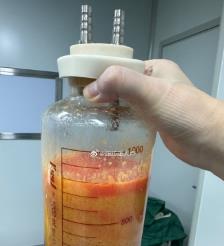 塔城水动力吸脂手术要做多久？